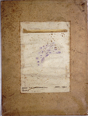 ツツガムシ病の病原体切片標本2