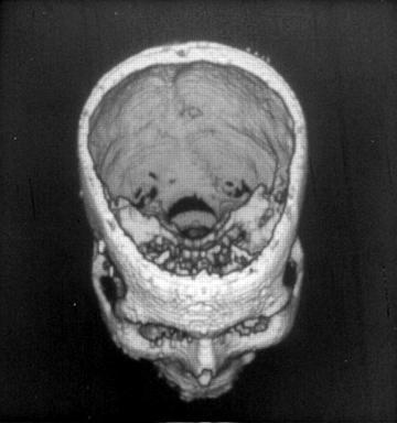 [ミイラの頭蓋骨復元像の画像]