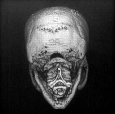 [ミイラの頭蓋骨復元像の画像]